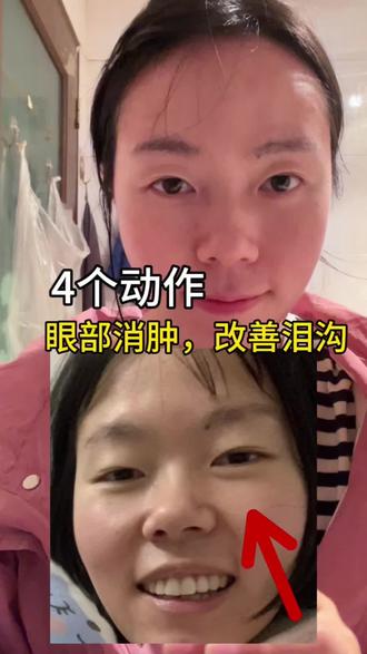 垮脸跟练打卡实测对✅
4️⃣个动作改善泪沟,眼部消肿#变美小技巧 #变美逆袭 #面部瑜伽 #眼袋 #泪沟