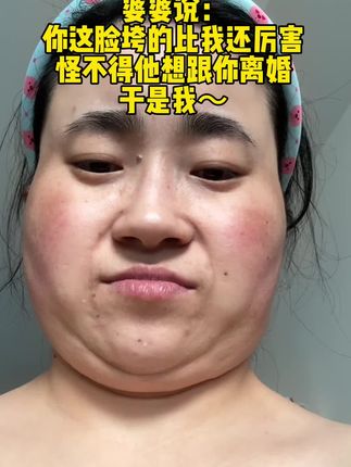 真后悔为什么早点没戴这玩意~#v脸神器 #提拉面罩 #V脸 #自用好物分享