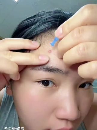 跟我一样爱长包包的,千万不要用手挤了,这种一次性的清洁工具安排起来#女生必备#痘痘肌 #我捡到宝了 #种草