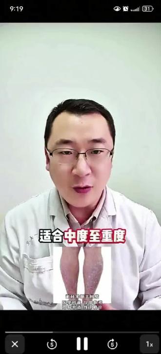 银屑病不耐药这款新药2个月打一针。#银屑病#安沐奇塔单抗#健康科普