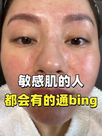 敏感肌人,都会有的通bing #敏感肌 #大红脸 #中医养肤 #内调外养 #经验分享