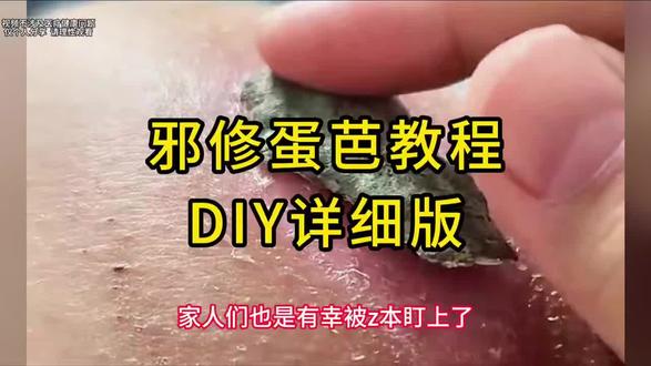 邪修🥚芭教程(diy教程版)#淡疤#疤痕#疤痕护理#剖腹产