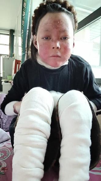 谢谢叔叔阿姨的关心和鼓励!