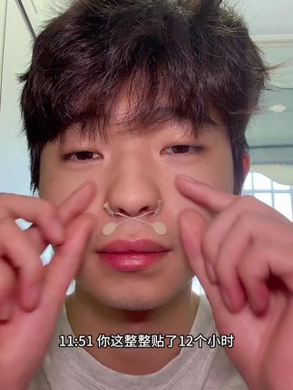 鼻翼宽鼻孔大!小哑铃鼻翼贴邪修#鼻翼贴 #小哑铃鼻翼贴 #鼻翼宽鼻孔大 #鼻翼贴测评