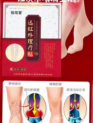 信玹堂远红外理疗贴,专为静脉曲张研发,是正规二类医疗器械认证的官方正品。它能三步缓解静脉曲张,深入静脉层层渗透,起到消肿止痛、辅助消炎、促进足部血液循环的作用,有助于缓解经脉曲张引起的疼痛。适用于因长时间站立、坐着、穿高跟鞋、交叉双腿等导致的酸、麻、胀、痛、热、痒等静脉曲张问题,像触痛、腿肿、下肢麻木、皮肤发红、针刺感、奇痒感等症状,贴一贴都能得到缓解。使用时,先将曲张部位用热毛巾清洗干净,打开包装取出内贴,揭去离型纸后贴敷在相应部位即可。