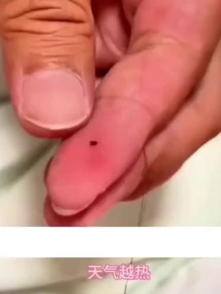 强力跳蚤药床上用品室内房间非无毒强力跳蚤药儿童喷雾家用杀虫剂