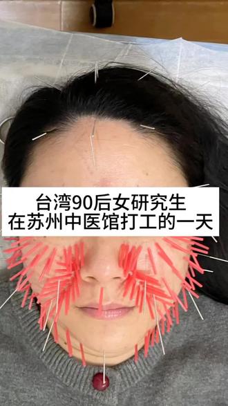 台湾90后女研究生在苏州中医馆打工的一天#苏州 #打工人 #针灸调理