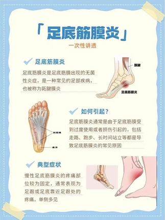 #足底筋膜炎 #足跟痛 #足跟疼痛 #足底筋膜 #脚底板疼痛 足底筋膜炎别拖,等走不成路就晚了!