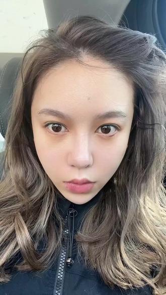 今天是双韧焕颜提升的第三天
#双韧焕颜提升#面部提升#变美#垮脸