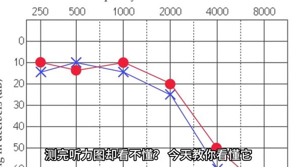 测完听力图却看不懂?今天教你看懂它
测完听力图
全是圈圈叉叉看不懂?
今天教你看懂它。
首先,听力图有两条轴。
从上到下是强度,
耳能听到的最小声音强度就叫听阈。
以分贝为单位,
数值从0开始,到底部120分贝。
从左到右是频率,
以赫兹为单位测量
左边低频,
右边高频,
就像钢琴的琴键一样。
在一张听力图上,
您会看到有两条线,
带X符号的线代表你的左耳,
带圆圈符号的线代表你的右耳。
它们落的位置,
就是你的听力阈值。
现在开始,
从低频开始依次记录听阈。
如果您的听力正常,
会在0到20分贝范围内,
看到一个标记符号;
标记符号在20到35分贝范围内,
属于轻度听力损失;
在35至50分贝范围内,
属于中度听力损失,
主要表现为安静环境下可能听不清谈话声,
正因如此,
家人或者朋友往往会在这个阶段注意到你的听力问题。
50至65分贝范围,
属于中重度听力损失;
65至80分贝范围,
属于重度听力损失;
80至95分贝范围,
属于极重度听力损失;
符号标记出现在95分贝以上范围,
属于完全听力损失,
无论是安静环境还是噪声环境都听不到言语声。
#听力测试 #听力下降#助听器#耳鸣听力下降#助听器验配