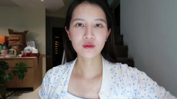 ♡ ·†产检经验分享|4️⃣家厦门著名🏥也是被我跑遍了
补充一下:
医院资质/医师团队/就诊环境/服务态度
*医院资质:三甲
*医师团队:
补充一个我踩过的坑,就是当时做四维彩超时,并不清楚彩超也分为一二三级,以下是deepseek的简单说明:
*一级超声:常规检查,测量胎儿大小、胎位等基础指标。
*二级超声:针对性结构筛查,检查胎儿器官是否存在明显畸形。
*三级超声:针对高危孕妇或疑似异常胎儿的系统性深入检查,包含四维彩超对胎儿面部、肢体、内脏的动态观察。
*四维彩超因需高分辨率设备和专业医生分析,明确归类为三级超声。其核心价值在于通过动态影像发现细微结构异常(如唇裂、心脏畸形),而非简单的“拍照留念”。
所以我当时产检的医院是视频里的三级医院,他们在并未告知我的情况下,直接给我约了二级彩超。
这在我辗转了多家三甲医院,医生在看了四维报告后才得知,这并不符合国家标准。
*就诊环境
在环境方面,私立吊打公立
但公立可报销的项目多,且便宜,私立相反。
*服务态度
这个跟就诊环境是息息相关的,有时候并不是公立态度不好,而且真的人太多他们来不及回复你。我目前就诊过的这四家并没有遇到态度差的情况。
以上就是我的产检经验分享,大家可以随意参考下,再结合自身需求决定产检和生产医院~~
#日常分享 #产检 #孕妇 #孕妇日常 #产检记录