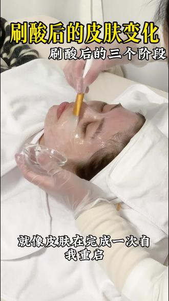 厦门刷酸|刷酸后的七天你的皮肤在经历什么?
#厦门皮肤管理 #厦门刷酸 #厦门针清 #集美皮肤管理 #上热门