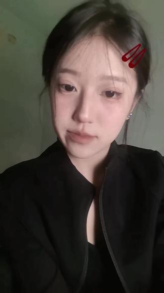 #土豆 刚才怎么了镖镖 宝镖 宝宝 担心死我了-O-