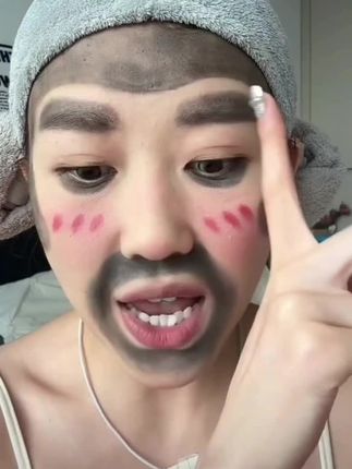 #单眼皮 #内双#肿眼泡 #双眼皮贴