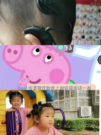 最好启蒙不是完美,是包容,而每一种不同都值得被看见和尊重。#听力障碍 #耳蜗宝宝 #乔治听障 #被看见是治愈的开始 #真实生活分享