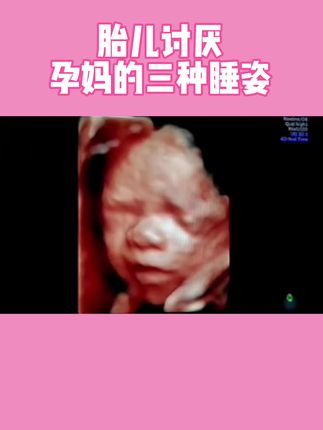 胎宝宝讨厌#孕妈 的三种睡姿,特别是到了孕中晚期,妈妈尽量侧卧睡#怀孕 #孕期囤货 #孕妇枕 #孕妇的正确睡姿