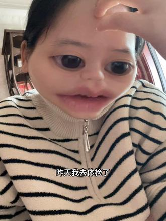 没啥大毛病 全是小毛病#体检报告 #体检