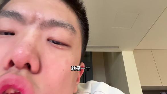 孤独症这个孩子挺多