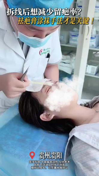 拆线后想减少留疤率,祛疤膏涂抹手法才是关键!
#贵阳双眼皮杜兴隆 #双眼皮 #双眼皮手术 #祛疤膏 #眼整形