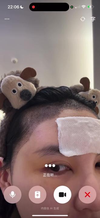 植发第五天,豆包专业分析#植发手术