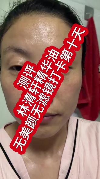 今天是我用林清轩精华油无美颜无滤镜打卡第十天啦。赶紧皮肤紧致了些许,继续坚持试试😃 #以油养肤精华油 #一起变美变好看 #测评 #护肤经历分享