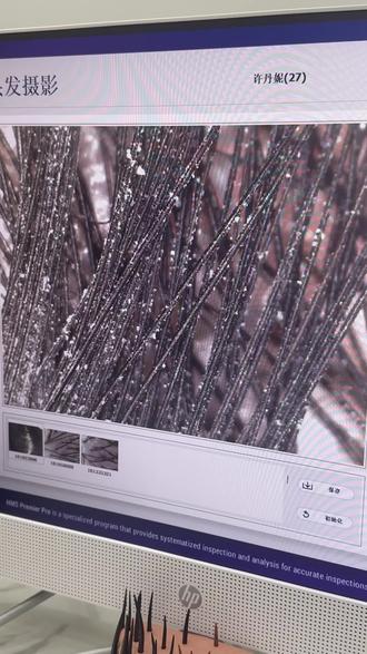 油头洗发水真实测评!这回大油头必须看:#惊时控油洗发水 #控油洗发水 #洗发水推荐 #油头洗发水 #过年洗头