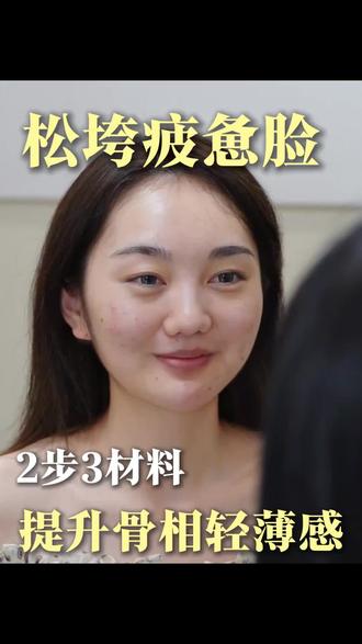 25+垮脸微调?照抄这个就够了~
#微调注射#皮贴骨#玻尿酸#成都医美#轻薄脸