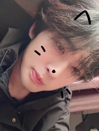 长了个粉刺#少年感 #小卷毛 #侧脸