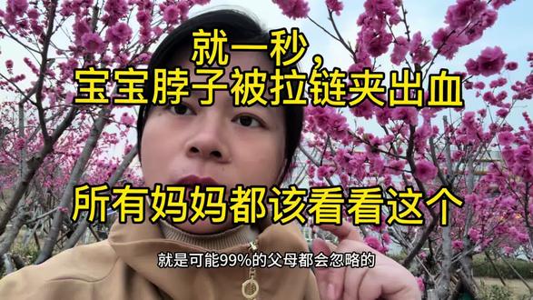 #真实生活分享计划 一个很小,但对宝宝来说很疼的安全隐患
#儿童安全 #宝妈必看 #育儿经验分享 #宝宝护理