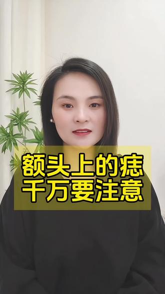 #上热门 额头上有痣,千万要注意!#痣 #痣的魅力发散时间 #痣祛福来 #枣庄同城@抖音小助手