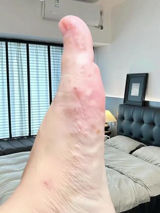 #可爱的小脚丫 #记录我的日常生活