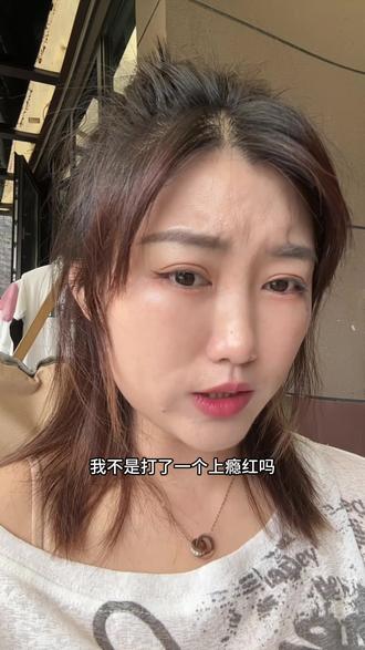 打完第三天#医美 #艾维岚 #抗衰