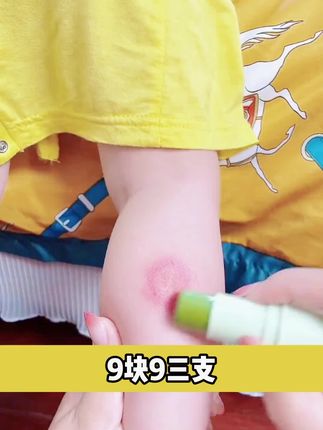 夏天热了,总被蚊子叮的,一定要备上这款#紫草膏#紫草舒缓棒#防蚊虫#草本防蚊虫
