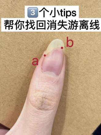 90天拯救两侧游离线!#养甲#养甲床#护甲膏