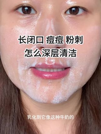 长闭口,黑头,痘痘,一定要做一做深层清洁!皮肤太舒服了 #美妆博主爱用韩妆好物分享 #深层清洁 #深层清洁肌肤方法 #深层清洁卸妆油