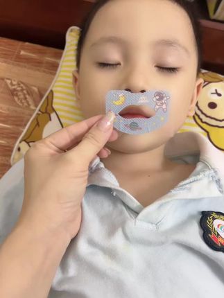 一直担心宝宝睡觉时张口呼吸,牙齿凸,嘴巴翘,打呼噜,牙齿嘴巴变凸,这款闭口贴贴上不影响孩子的呼吸和睡觉,贵在坚持,值得一试