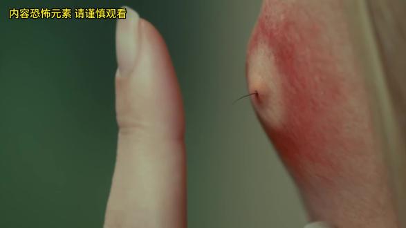 小美脸上长痘痘竟然是虫子#影视解说 #rap解说电影 #青年创作者 #二次元