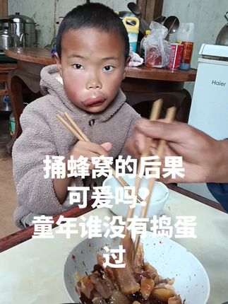 #记录生活 捅蜂窝的后果 可爰吗? 童年谁没有捣蛋过 谢谢大家的关心,周末回来被蛰了,今天己消肿,农村娃儿捅蜜蜂箱子的后果,不过,因为抵抗力强,己无大碍。 如果是城里人么娃儿哭爹喊娘,父母急了送医院急症啦! 甜棕种植基地工人的孙子,不打针吃药,己消肿读书。他爷爷64岁还在我127亩种植基地帮打理,育甜棕苗,给大棕树施肥除草,这段时间么剥棕花。想种植可垂询技术15987757006。 不过,我保留此视频,作为他结婚时的背景,该是乐声一片,您们说呢???????欢迎您们评论区留言。