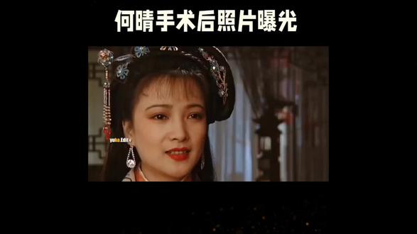 何晴生前术后照片曝光