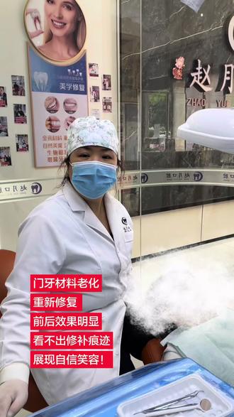 修补我的大门牙 ~哒哒哒哒哒哒哒~#工作日常记录 #口腔医生
