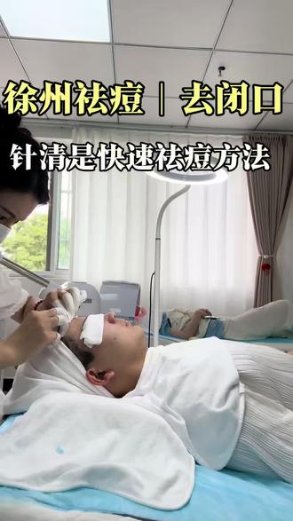 徐州祛痘
针清需要多久做一次、确实做一次效果好一次
#徐州针清 #徐州祛痘 #闭口 #痘痘 #针清