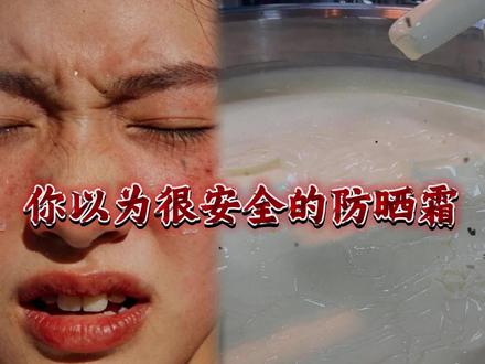 你以为很安全的防晒霜,其实是刺激泛红的隐形杀手!#防晒霜#春季防晒霜#蕾珂美防晒霜 #安耐晒防晒霜#防晒霜推荐