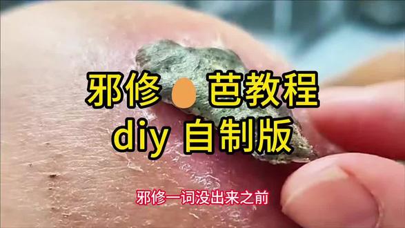 邪修🥚芭教程(diy教程版)#淡疤#疤痕#疤痕护理#剖腹产