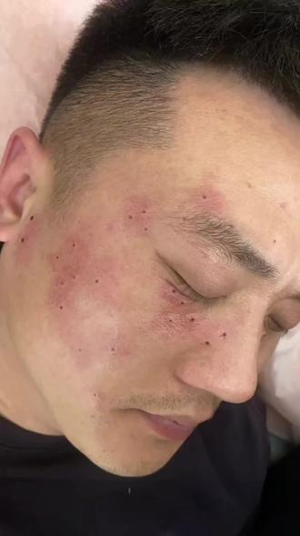 你脸上所有的斑斑和暗黄,都是你向生活妥协的痕迹,请管理好自己的皮肤#袪斑 #皮肤管理