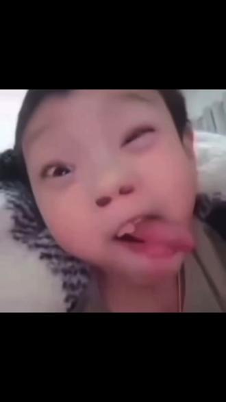 最近怎么一直打喷嚏#打喷嚏教程