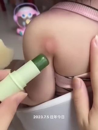 被蚊子叮咬后反反复复的痒就常备上这个#紫草膏,清清凉凉,植物成分安全,孕妈妈和宝宝都可以用#蚊虫叮咬 #防蚊
