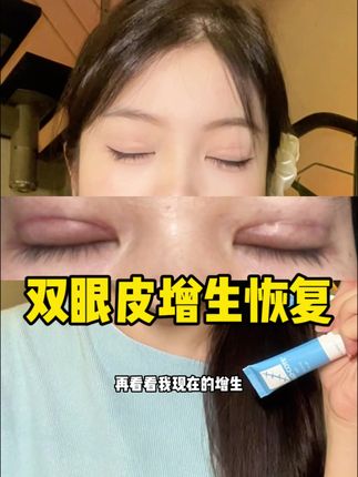 芭克别贵了#芭克硅凝胶 #芭克去疤膏 #芭克