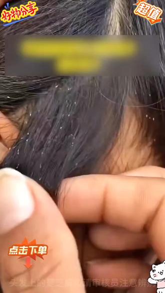 头虱去虱香波小女孩通用头发去儿童头上除百部酊非药洗虱子虱卵洗发水