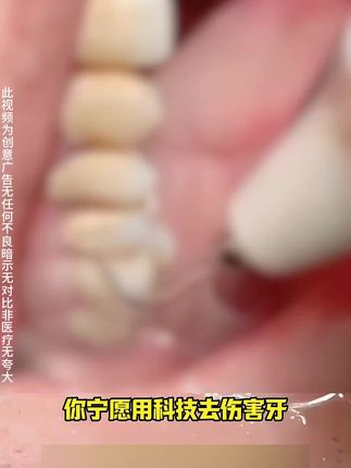 我自己用了快2周,被这支变色牙膏有的效果说服了!#美白牙膏#色修牙膏#浪漫高手#无限回购的宝藏单品#国货