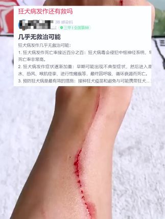 抓成这样怎么可能不担心,比起受伤后的担心受怕,还是建议提前给它测一下,这样是否有知道后就会更放心 #萌宠好物 #养宠进阶指南 #猫狗抓伤 #养猫经验分享